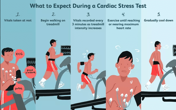 stress test what to expect
